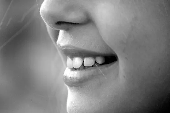 Tandimplantat kostnad - priset för ett leende